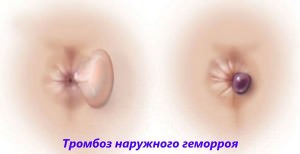 Статьи