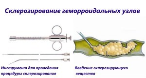 Лечение