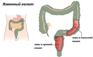 Статьи