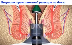 Лечение