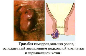 Стадии