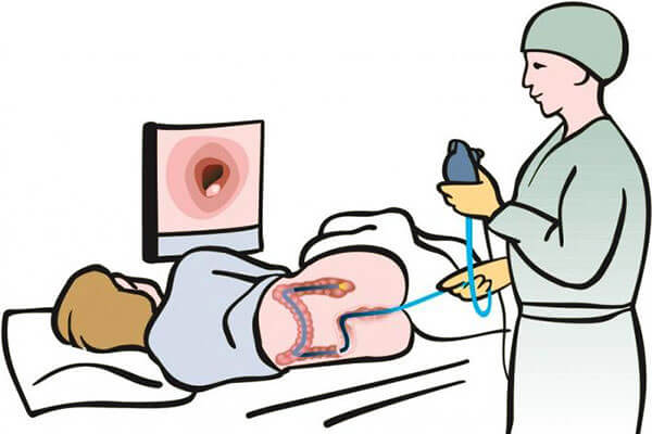 Колоноскопия кишечника