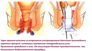 Стадии