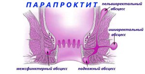 Лечение