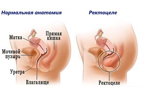 Статьи