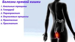 По каким причинам появляются резкие боли внизу живота