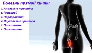 Статьи
