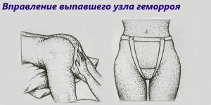 Лечение