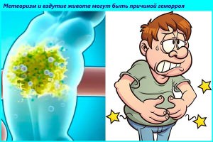 Симптомы